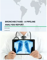 Bronchiectasis - A Pipeline Analysis Report